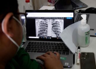 Progres Penanggulangan TBC: Dua Provinsi Lampaui Target Nasional